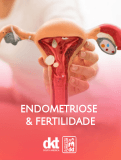 Endometriose & Fertilidade