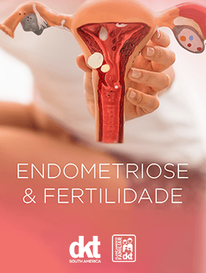 Endometriose e Fertilidade